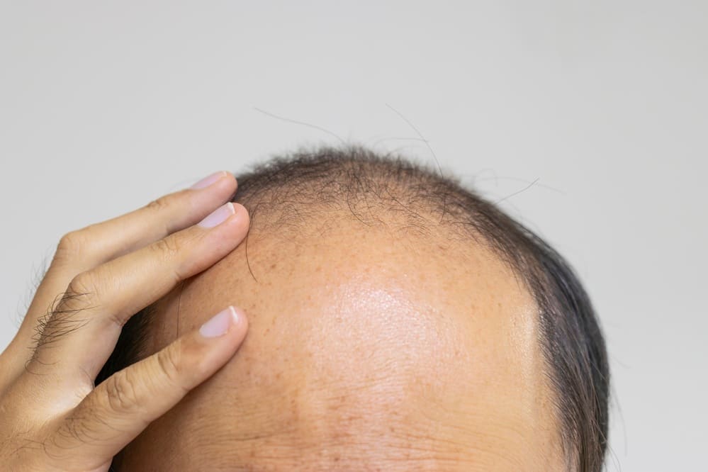 Best Peptides for Hair Growth: GHK-Cu & Beyond (Doctor-Ranked 2026)
