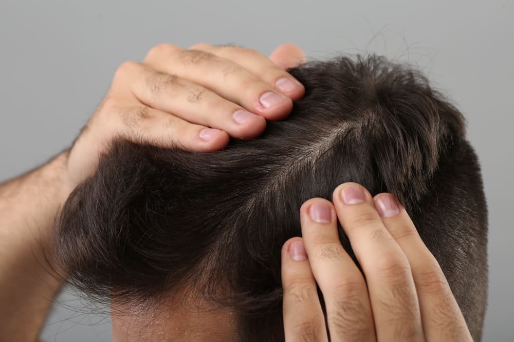 The Best Clinical Protocols for Scalp Rejuvenation and Improved Hair Health