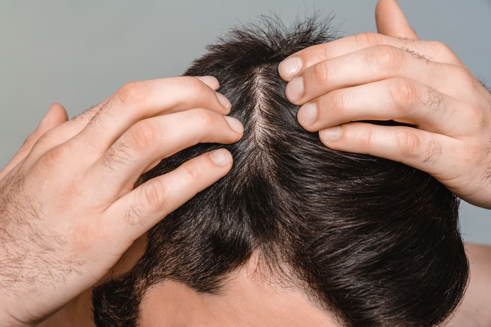 Advanced Biohacking: Optimizing Hair Density and Scalp Health with Copper Peptides