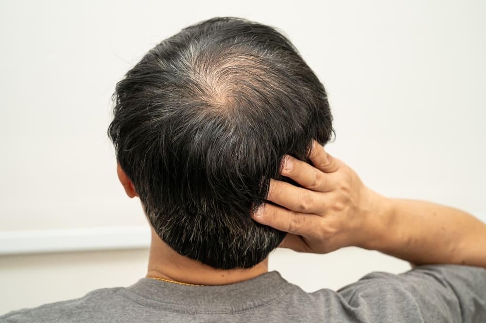 What to Look for in High-Quality GHK-Cu Hair Foams and Formulations